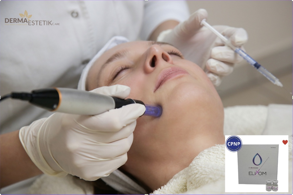 Microneedling ELIXOM - Dermapen s exosomy