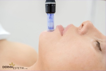 Microneedling - Obličej, krk a dekolt