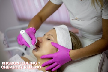 Microneedling + CHP - Obličej 